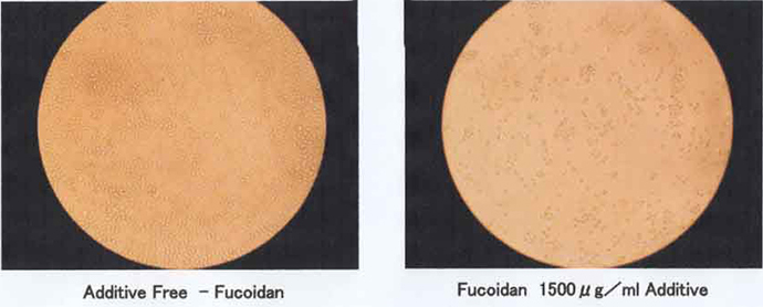Tác dụng chống ung thư của Fucoidan